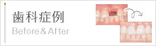 歯科症例